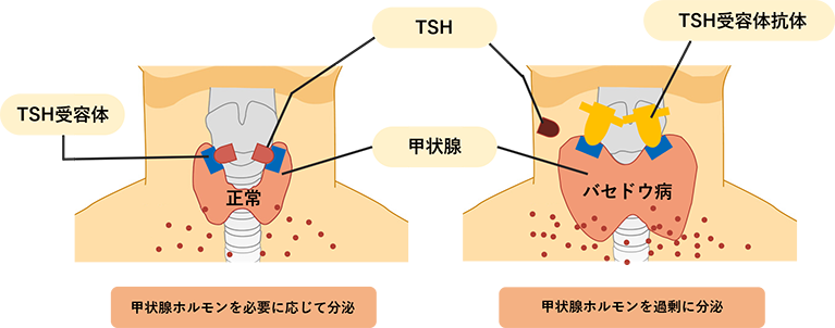 首にしこり 腫れがある 甲状腺疾患など 東大阪のながた耳鼻咽喉科クリニック