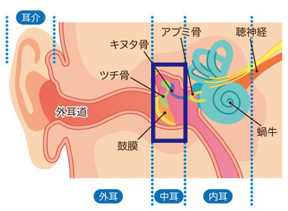 急性中耳炎