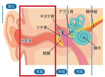 外耳炎とは？